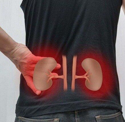 Lows Schmerzen können bei Pyelonephritis auftreten