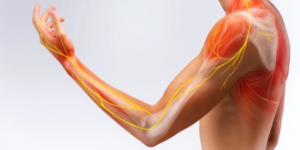 Schmerzen und Taubheitsgefühle in den Fingern weisen auf eine Schädigung der Bänder aufgrund einer stenosierenden Ligamentitis hin
